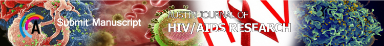hiv-aids-research-sp-h1