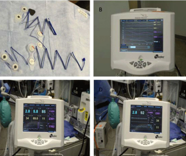 Austin Journal of Anesthesia and Analgesia Open access journals