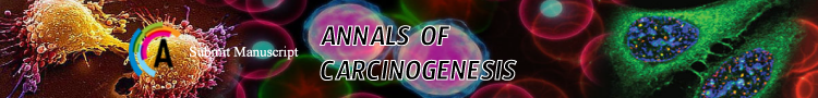 carcinogenesis-sp-h1