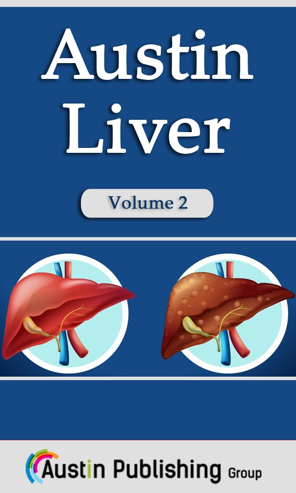 Austin Liver