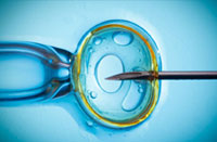 Special Issue on Infertility