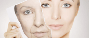Skin Aging And Modern Age Anti Aging Strategies